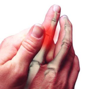 Pirkstu artrīts: ārstēšana, cēloņi, simptomi