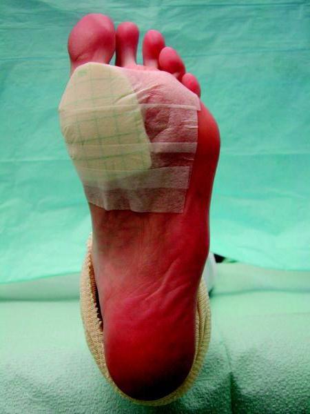 Trofiskās čūlas kāju ārstēšanā