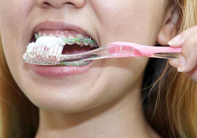 Zobu izlīdzināšanas plātnes: zobārstu un pacientu atsauksmes